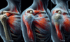 Acupuncture Techniques for Effective Relief from Frozen Shoulder