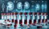 Kidney Blood Test: Essential Guide for Blackburn Locals