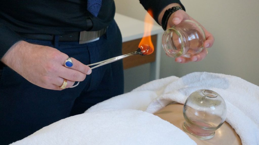 Cupping Therapy: Explore Its Healing Benefits in Melbourne