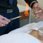Cupping Therapy: Explore Its Healing Benefits in Melbourne