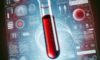Vitamin B12 Blood Test for Residents of Bridlington