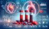 Cholesterol Blood Test Essentials for Milton Keynes Residents