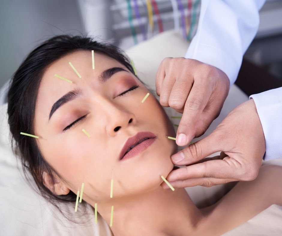 Cosmetic Acupuncture: Essential Drawbacks to Weigh Up
