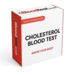 Cholesterol Blood Test: A Guide for Residents of Milton Keynes